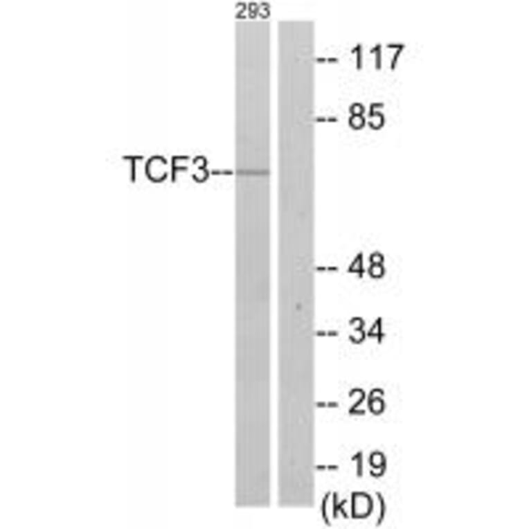Western blot - TCF3 Antibody from Signalway Antibody (33685) - Antibodies.com