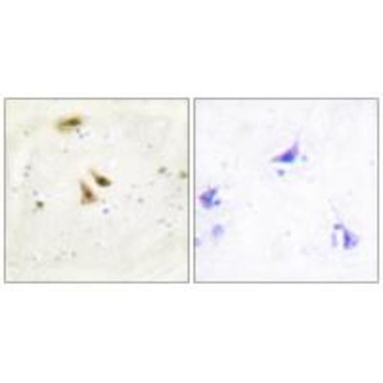 Immunohistochemistry - UBF1 Antibody from Signalway Antibody (33692) - Antibodies.com
