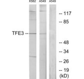Western blot - TFE3 Antibody from Signalway Antibody (33708) - Antibodies.com