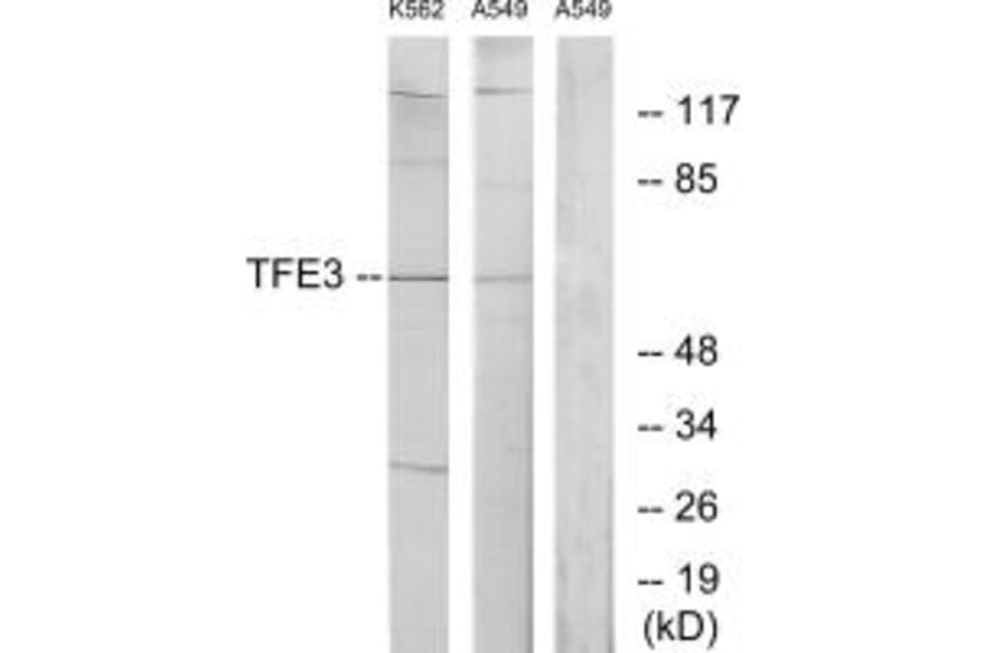 Western blot - TFE3 Antibody from Signalway Antibody (33708) - Antibodies.com