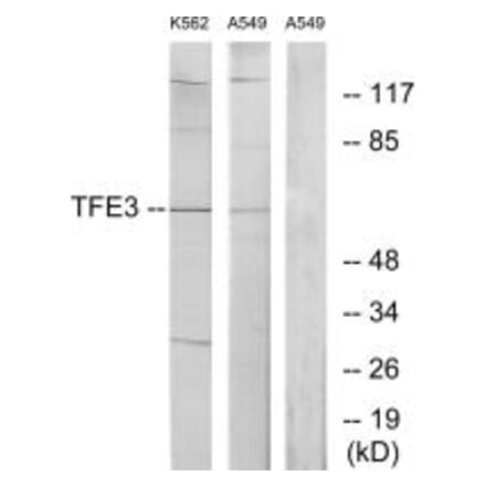 Western blot - TFE3 Antibody from Signalway Antibody (33708) - Antibodies.com