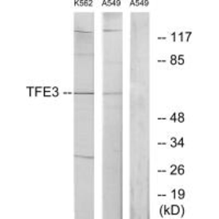 Western blot - TFE3 Antibody from Signalway Antibody (33708) - Antibodies.com