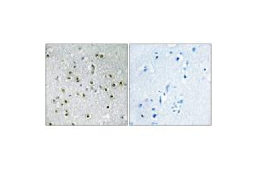 Immunohistochemistry - TFE3 Antibody from Signalway Antibody (33708) - Antibodies.com
