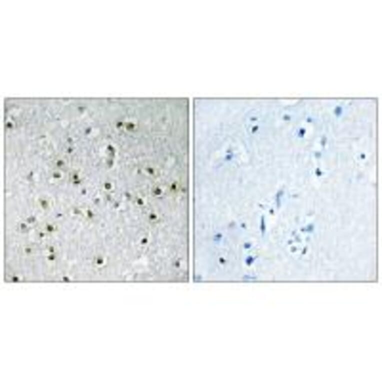 Immunohistochemistry - TFE3 Antibody from Signalway Antibody (33708) - Antibodies.com