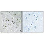 Immunohistochemistry - TFE3 Antibody from Signalway Antibody (33708) - Antibodies.com