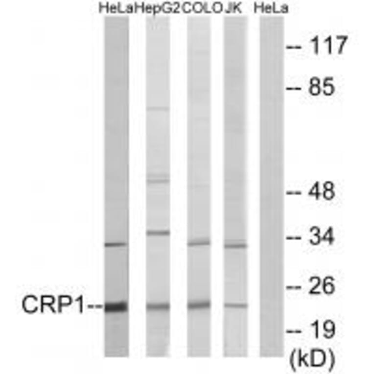 Western blot - CRP1 Antibody from Signalway Antibody (33713) - Antibodies.com