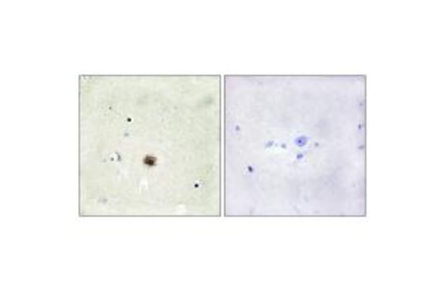 Immunohistochemistry - CRP1 Antibody from Signalway Antibody (33713) - Antibodies.com