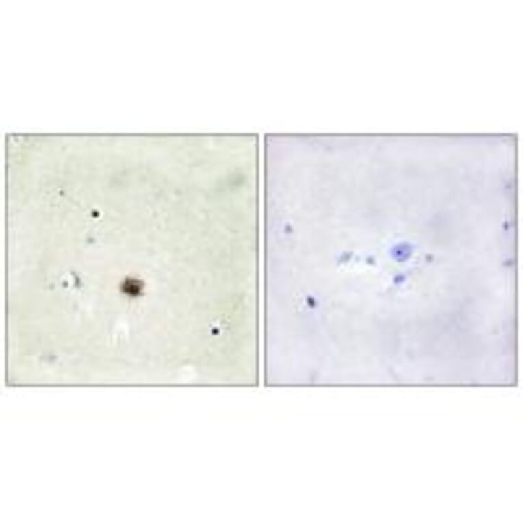 Immunohistochemistry - CRP1 Antibody from Signalway Antibody (33713) - Antibodies.com