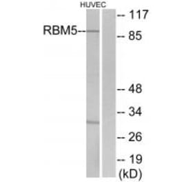 Western blot - RBM5 Antibody from Signalway Antibody (33808) - Antibodies.com