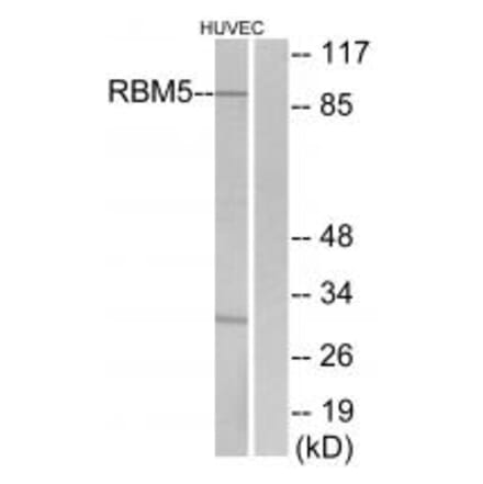 Western blot - RBM5 Antibody from Signalway Antibody (33808) - Antibodies.com