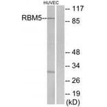 Western blot - RBM5 Antibody from Signalway Antibody (33808) - Antibodies.com