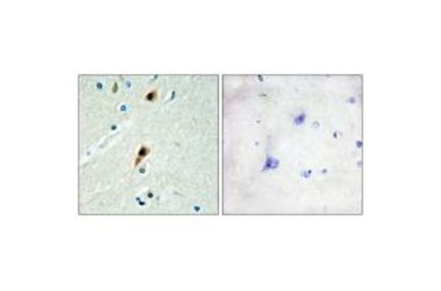 Immunohistochemistry - RBM5 Antibody from Signalway Antibody (33808) - Antibodies.com