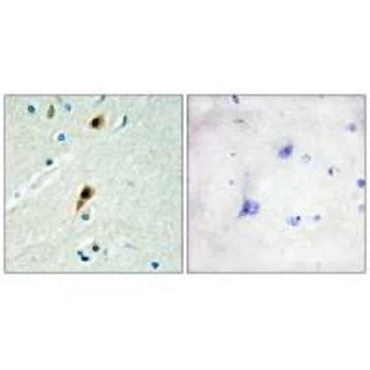 Immunohistochemistry - RBM5 Antibody from Signalway Antibody (33808) - Antibodies.com
