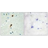 Immunohistochemistry - RBM5 Antibody from Signalway Antibody (33808) - Antibodies.com