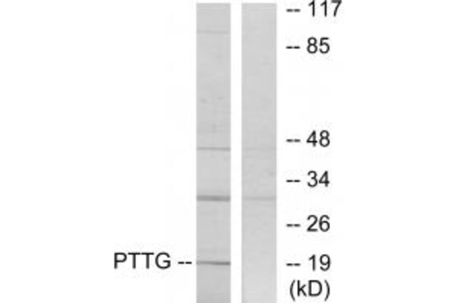 Western blot - PTTG Antibody from Signalway Antibody (33817) - Antibodies.com