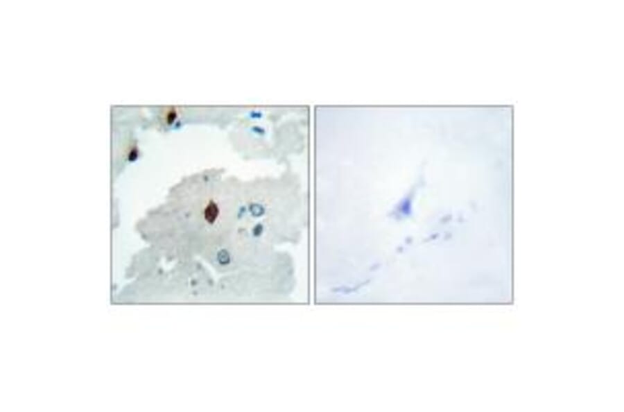 Immunohistochemistry - PTTG Antibody from Signalway Antibody (33817) - Antibodies.com