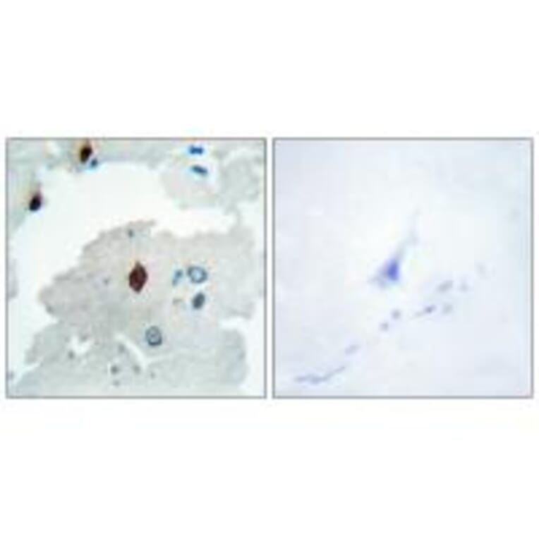 Immunohistochemistry - PTTG Antibody from Signalway Antibody (33817) - Antibodies.com