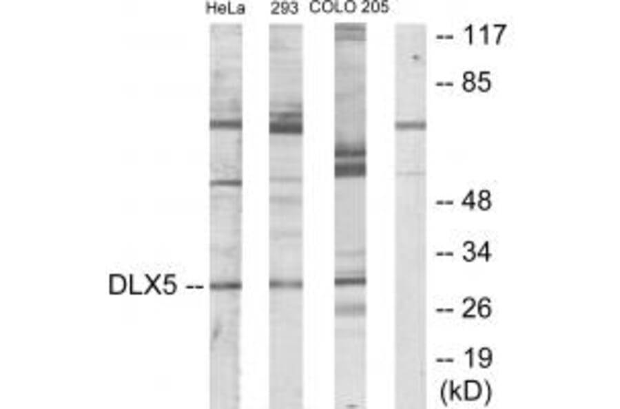 Western blot - DLX5 Antibody from Signalway Antibody (33825) - Antibodies.com