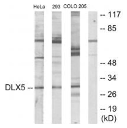 Western blot - DLX5 Antibody from Signalway Antibody (33825) - Antibodies.com