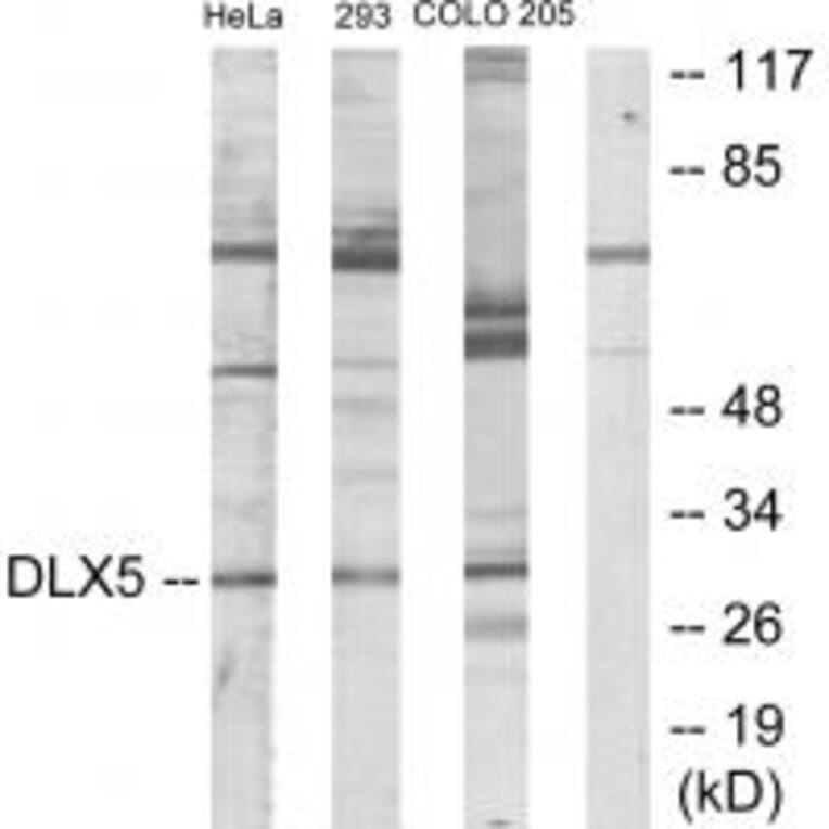 Western blot - DLX5 Antibody from Signalway Antibody (33825) - Antibodies.com