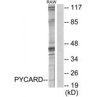Western blot analysis of extracts from RAW264.7 cells, using ASC antibody #34119.