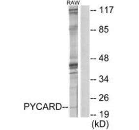 Western blot - ASC Antibody from Signalway Antibody (34119) - Antibodies.com