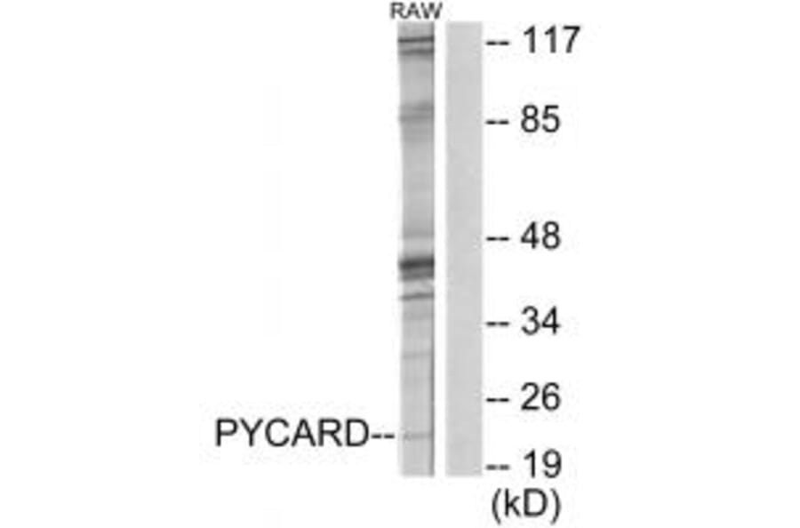 Western blot - ASC Antibody from Signalway Antibody (34119) - Antibodies.com