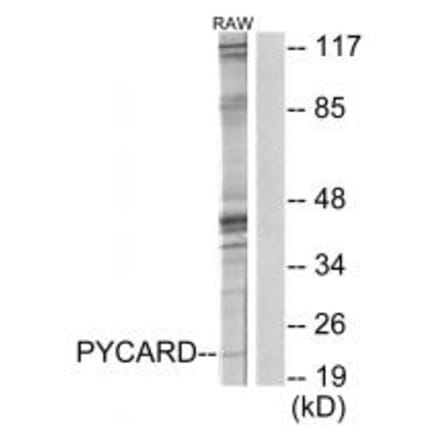 Western blot - ASC Antibody from Signalway Antibody (34119) - Antibodies.com