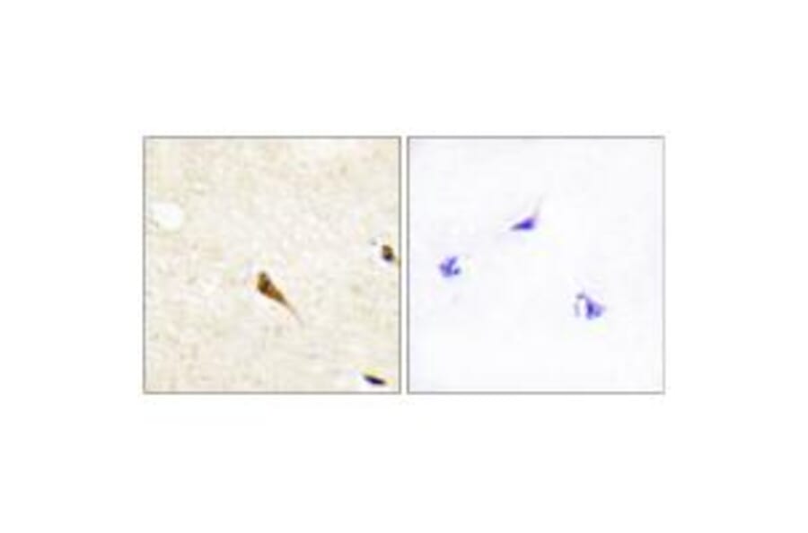 Immunohistochemistry - MOK Antibody from Signalway Antibody (34123) - Antibodies.com