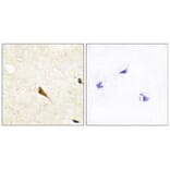 Immunohistochemistry - MOK Antibody from Signalway Antibody (34123) - Antibodies.com
