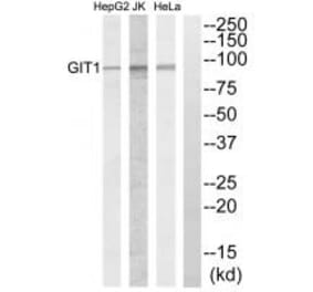 Western blot - GIT1 Antibody from Signalway Antibody (34131) - Antibodies.com