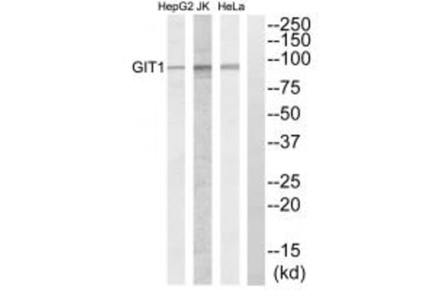 Western blot - GIT1 Antibody from Signalway Antibody (34131) - Antibodies.com