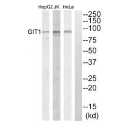 Western blot - GIT1 Antibody from Signalway Antibody (34131) - Antibodies.com