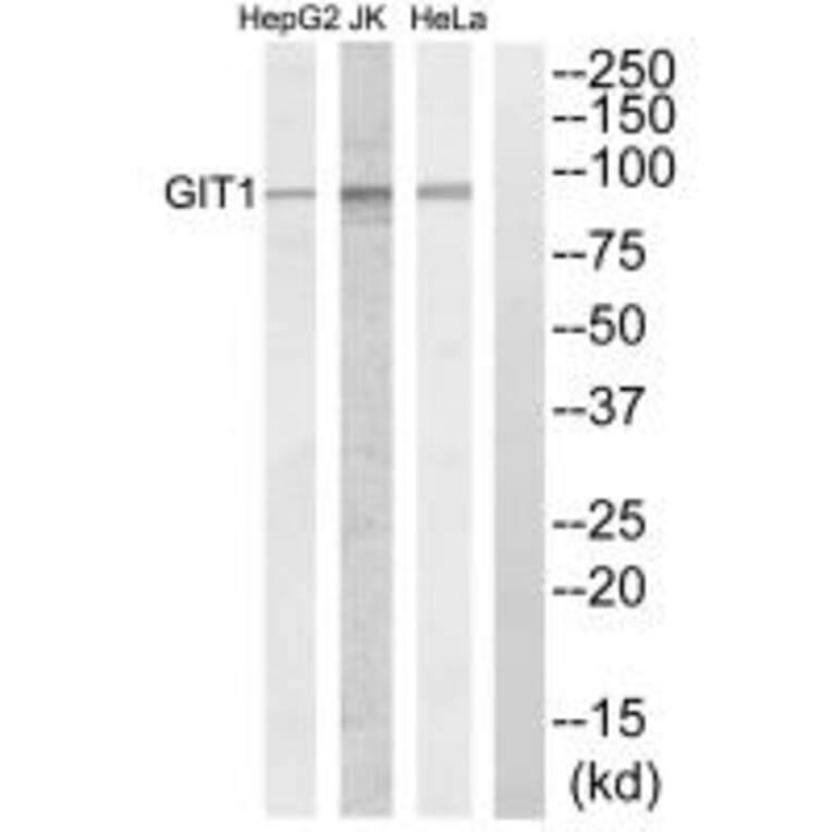 Western blot - GIT1 Antibody from Signalway Antibody (34131) - Antibodies.com