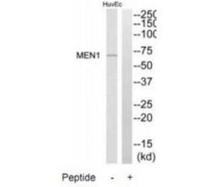 Western blot - MEN1 Antibody from Signalway Antibody (34285) - Antibodies.com