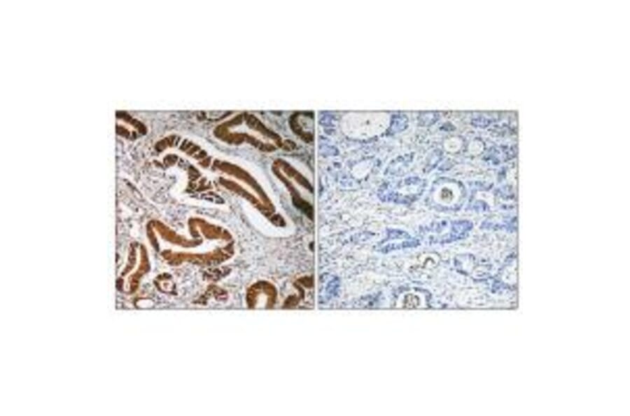 Immunohistochemistry - MEN1 Antibody from Signalway Antibody (34285) - Antibodies.com