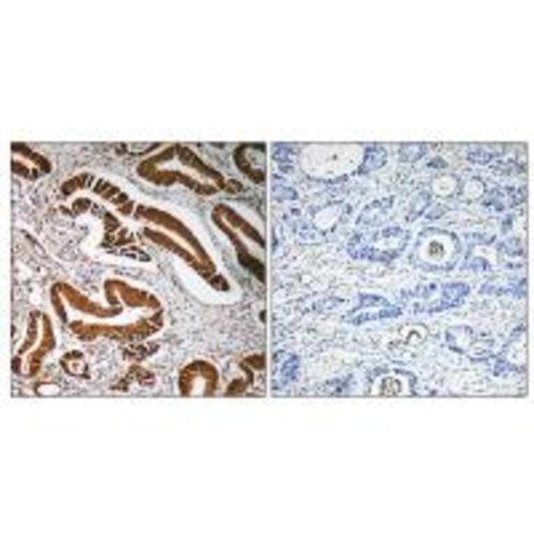 Immunohistochemistry - MEN1 Antibody from Signalway Antibody (34285) - Antibodies.com