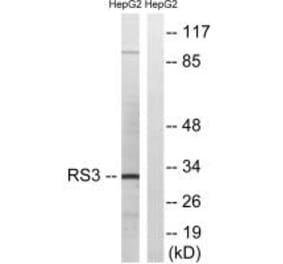 Western blot - RPS3 Antibody from Signalway Antibody (34338) - Antibodies.com
