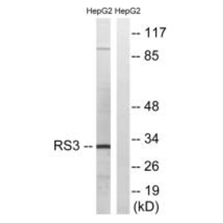 Western blot - RPS3 Antibody from Signalway Antibody (34338) - Antibodies.com