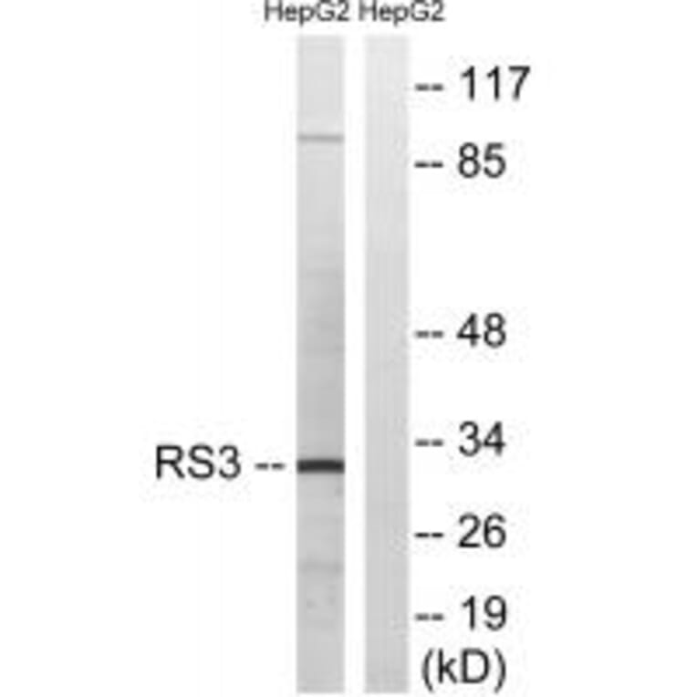 Western blot - RPS3 Antibody from Signalway Antibody (34338) - Antibodies.com