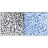 Immunohistochemistry - RPS3 Antibody from Signalway Antibody (34338) - Antibodies.com