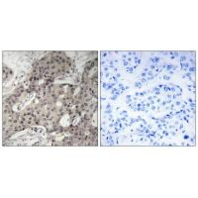 Immunohistochemistry - RPL3 Antibody from Signalway Antibody (34353) - Antibodies.com
