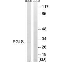 Western blot analysis of extracts from COLO cells, using PGLS antibody #34365.