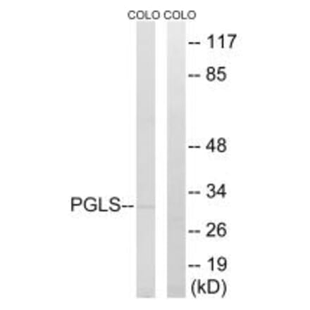 Western blot - PGLS Antibody from Signalway Antibody (34365) - Antibodies.com