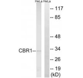 Western blot - CBR1 Antibody from Signalway Antibody (34544) - Antibodies.com
