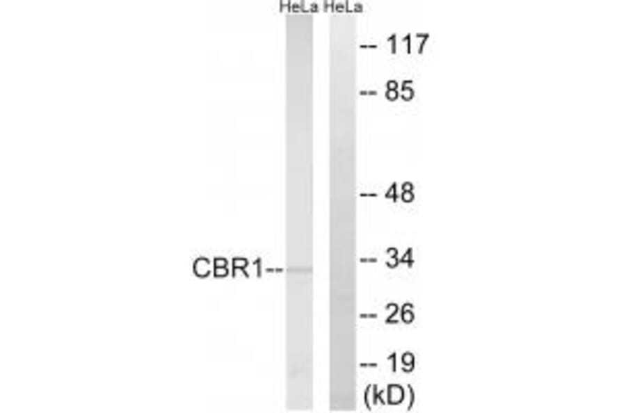 Western blot - CBR1 Antibody from Signalway Antibody (34544) - Antibodies.com