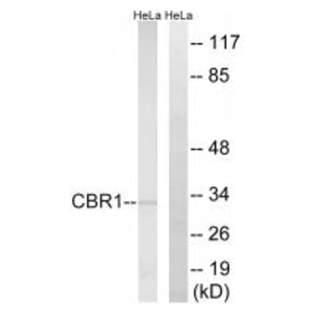 Western blot - CBR1 Antibody from Signalway Antibody (34544) - Antibodies.com