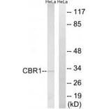 Western blot - CBR1 Antibody from Signalway Antibody (34544) - Antibodies.com