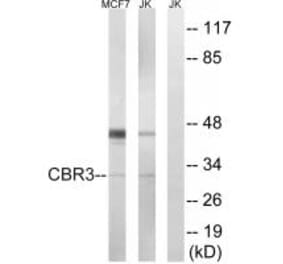 Western blot - CBR3 Antibody from Signalway Antibody (34545) - Antibodies.com