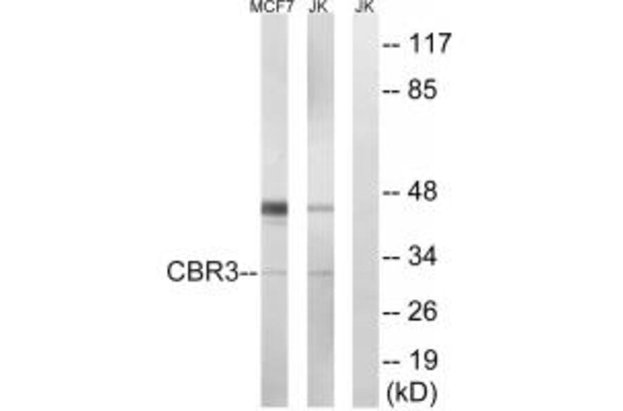 Western blot - CBR3 Antibody from Signalway Antibody (34545) - Antibodies.com
